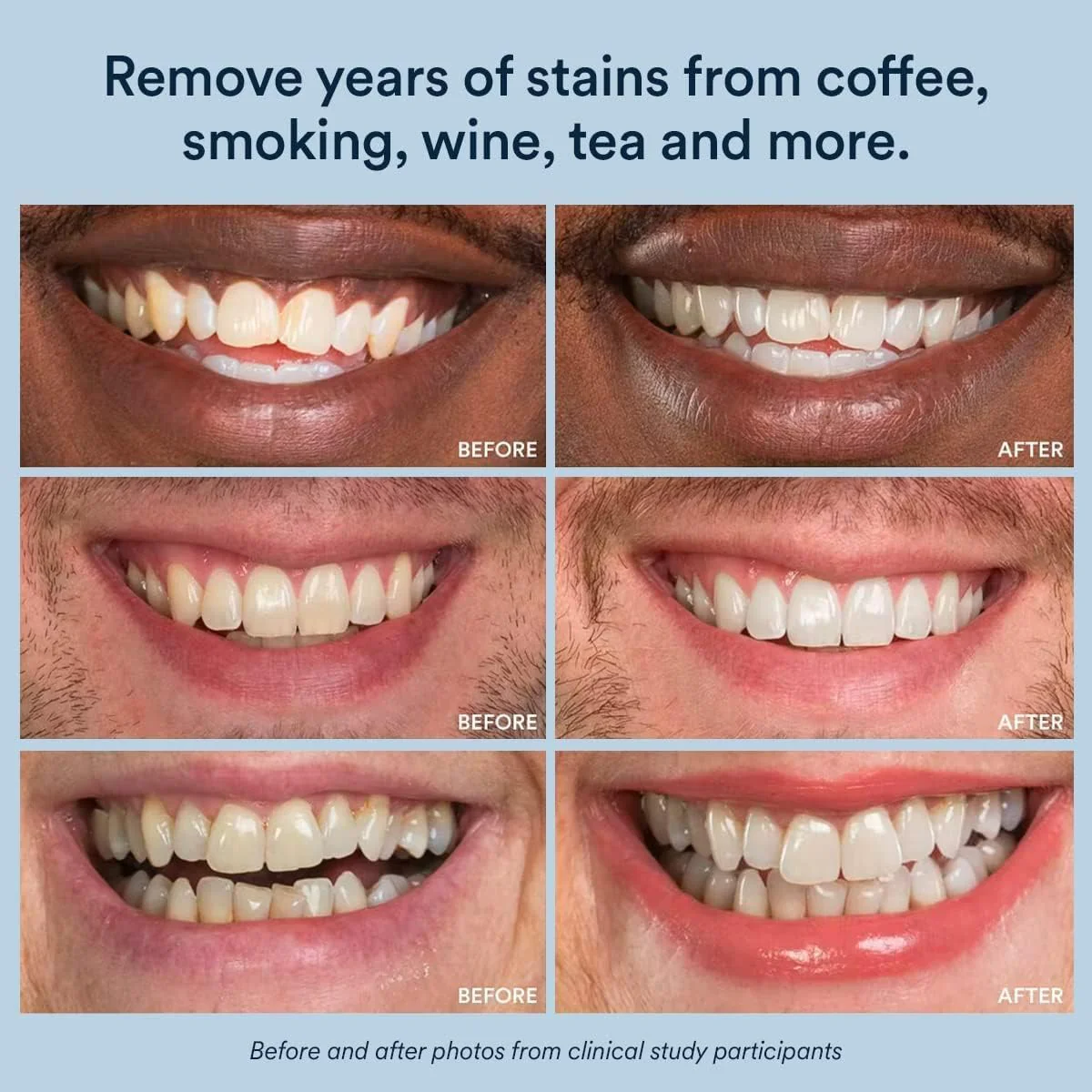 Hydrogen Peroxide Extra Strength Teeth Whitening Pen - Image 5